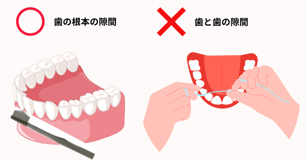 奇跡の歯ブラシを実際に使ってみて感じたデメリット。歯の根本の隙間へ磨けるが、歯と歯の間はフロスが必要。